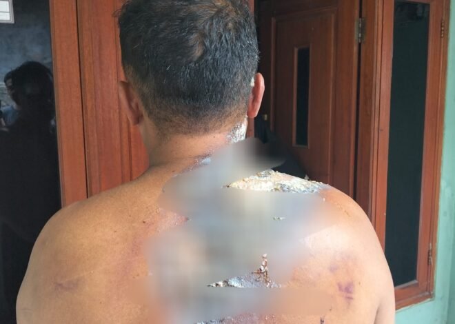 Sempat Diamankan di Polsek Cileungsi: Dugaan Main Hakim Sendiri, Korban Alami Luka Bakar dan Luka Robek