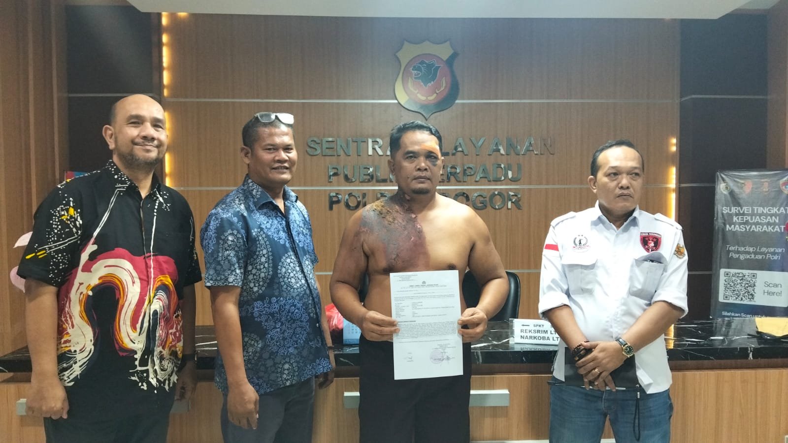 Kasus Dugaan Penganiayaan di Cileungsi Masuk Penanganan Polres Bogor